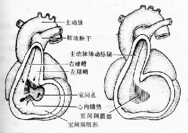 三心脏内部的分隔
