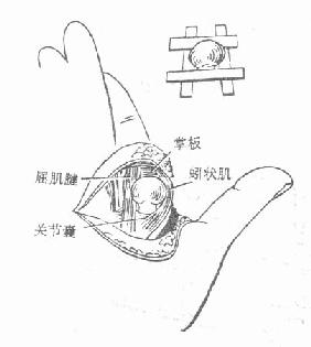 五掌指關節脫位