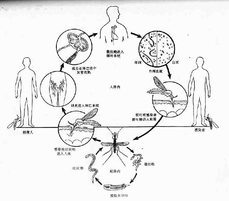 丝虫病生活史图片