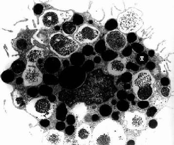 肥大细胞光镜图图片